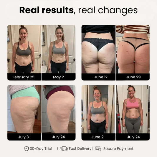 The science behind anti-cellulite 3D leggings: myth or reality?