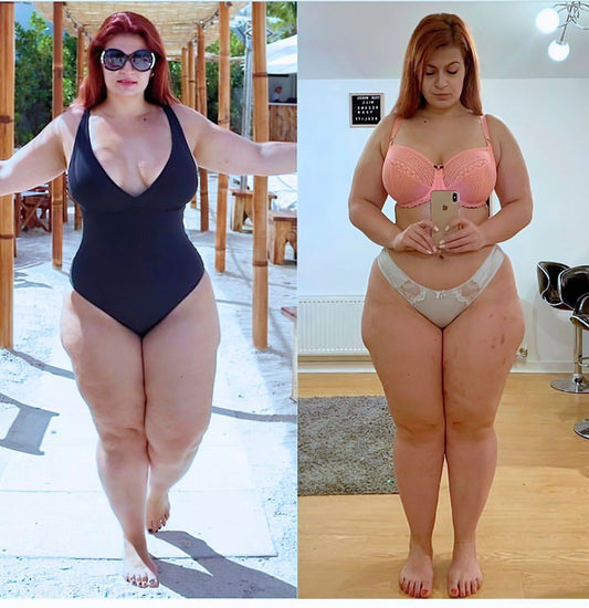 Is collagen good for cellulite ?