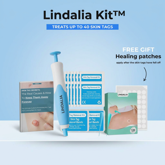 How to Remove Skin Tags at Home Safely, and When You Absolutely Should Not