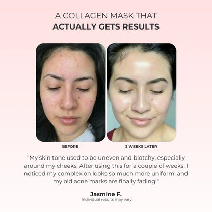 Masque Peel-Off a l'Acide Kojique