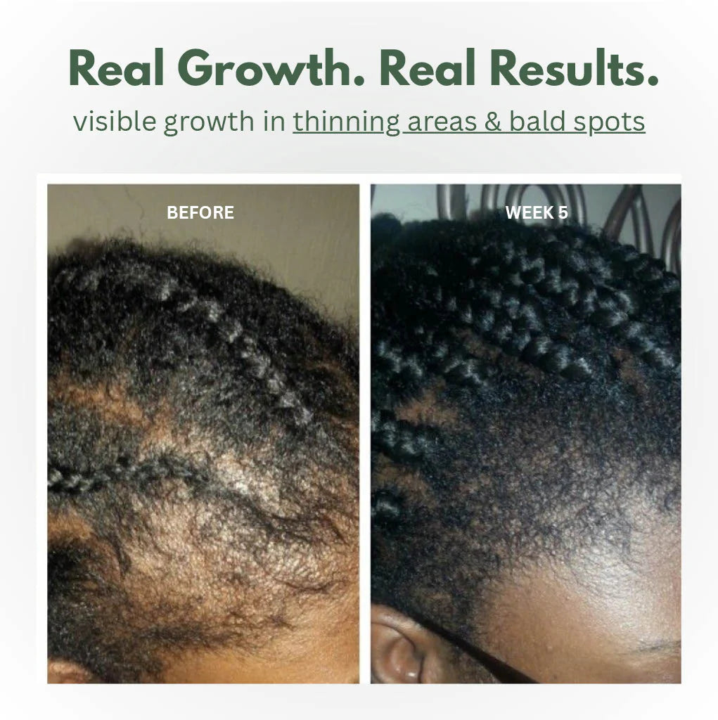 Batana Oil Scalp Serum
