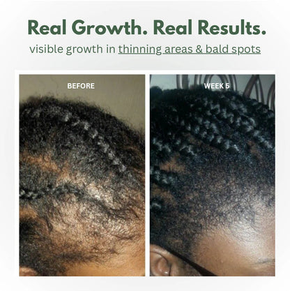 Batana Oil Scalp Serum