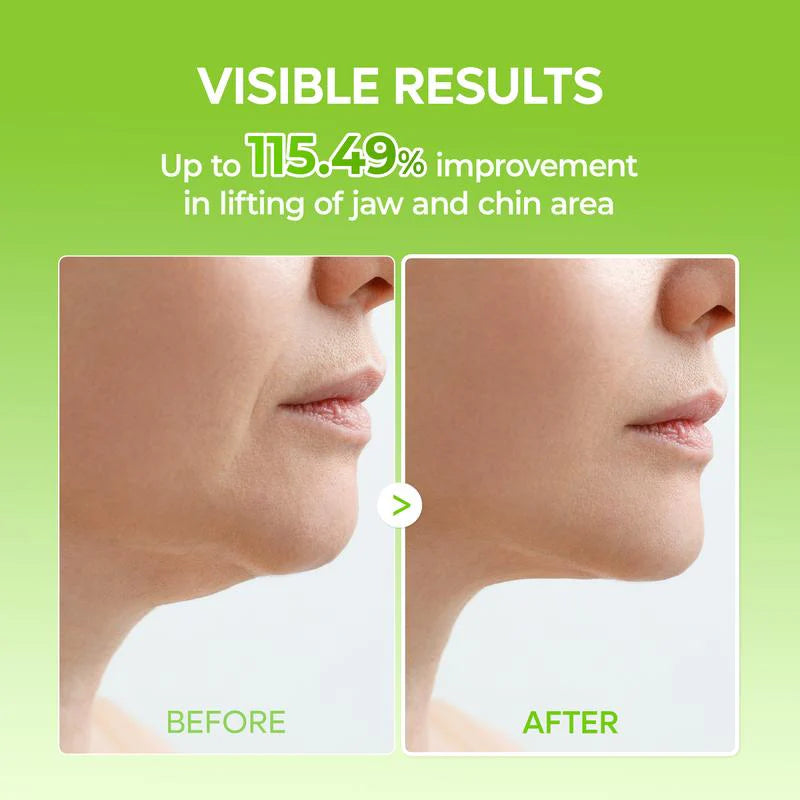 V-Line Lifting Chin Band (4-Pack)