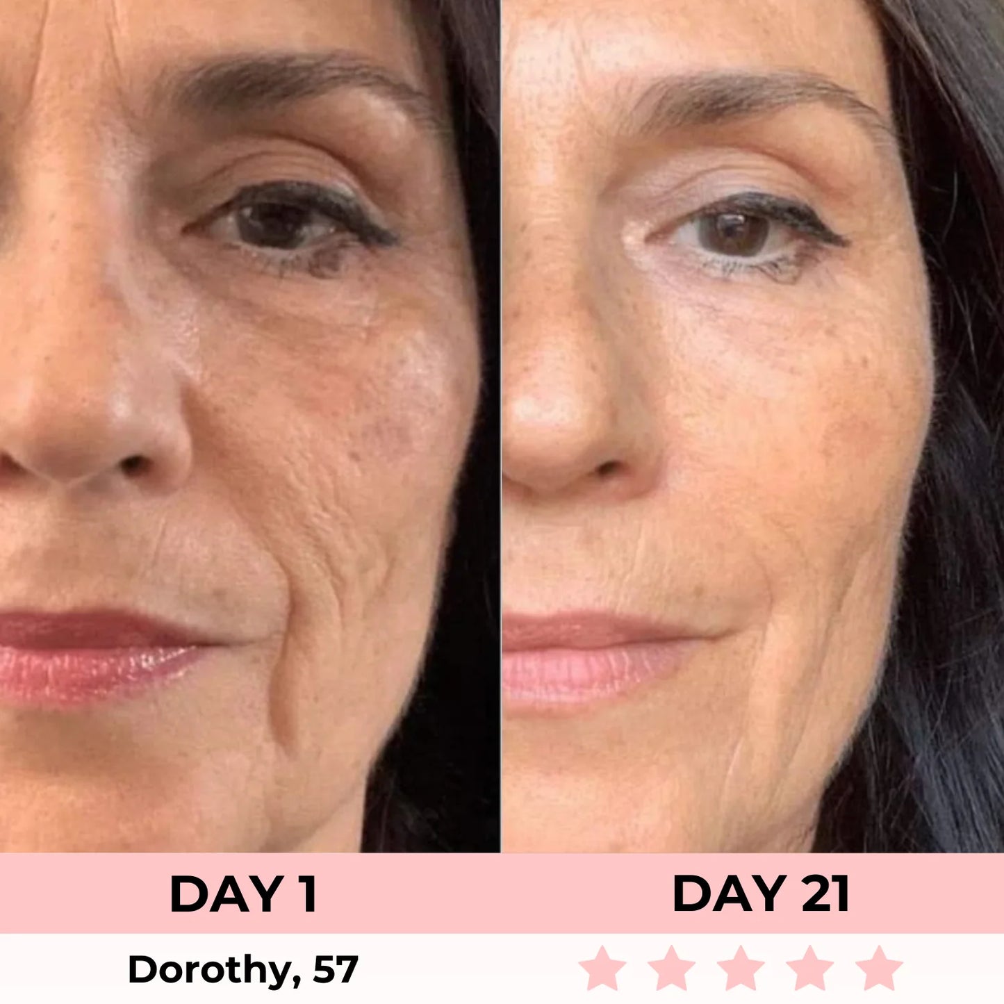 Masque Peel-Off a l'Acide Kojique