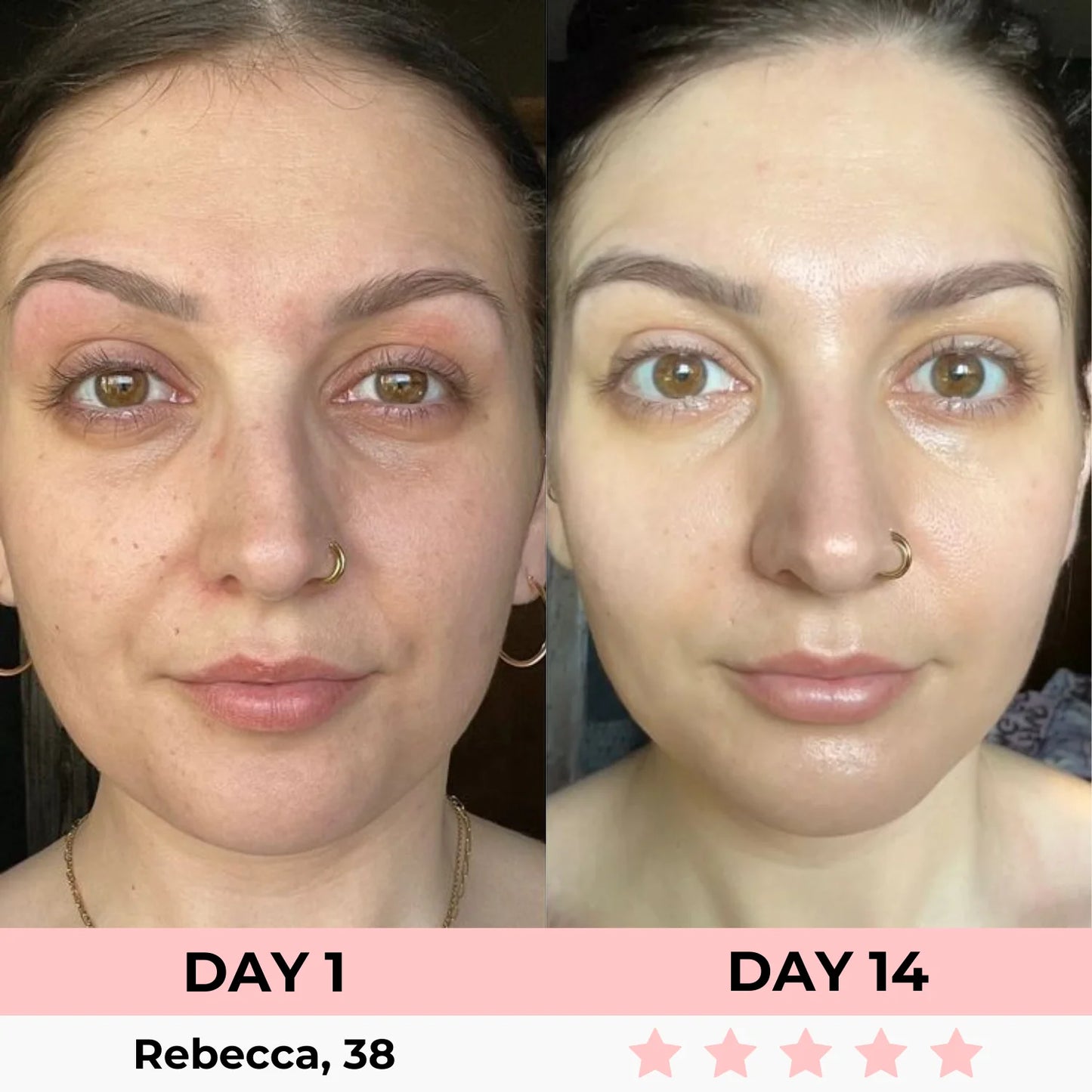 Masque Peel-Off a l'Acide Kojique