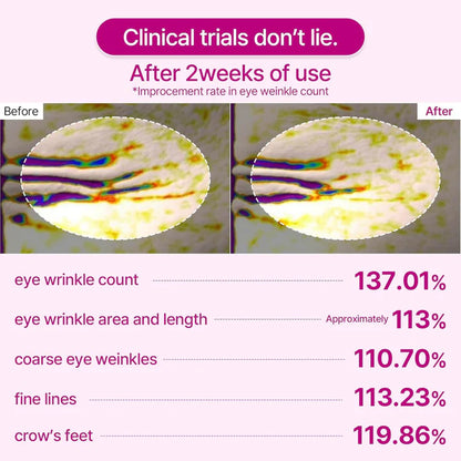 Patchs Yeux Anti-Rides au Collagene et Calcium