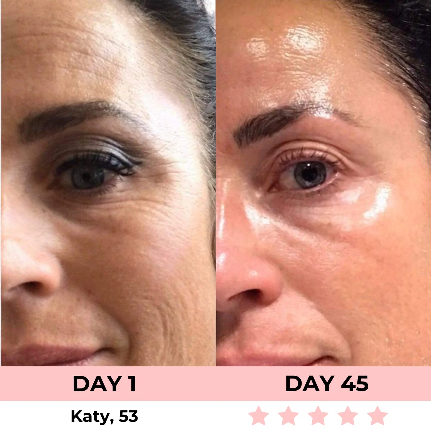 Masque Peel-Off a l'Acide Kojique