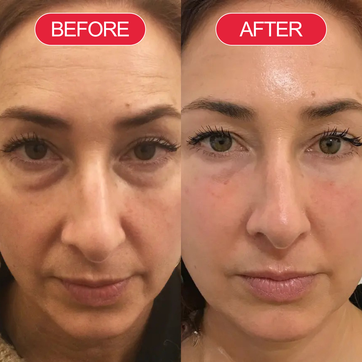 Lindalia Time Reverse cream before and after