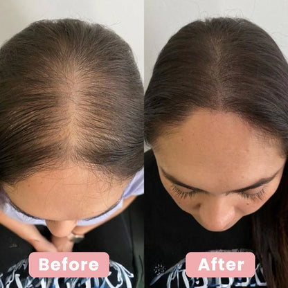 4-in-1 Haar-Therapie-Bürste