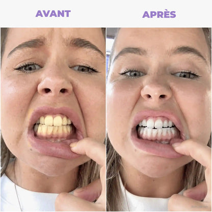 Bain de bouche blanchissant violet