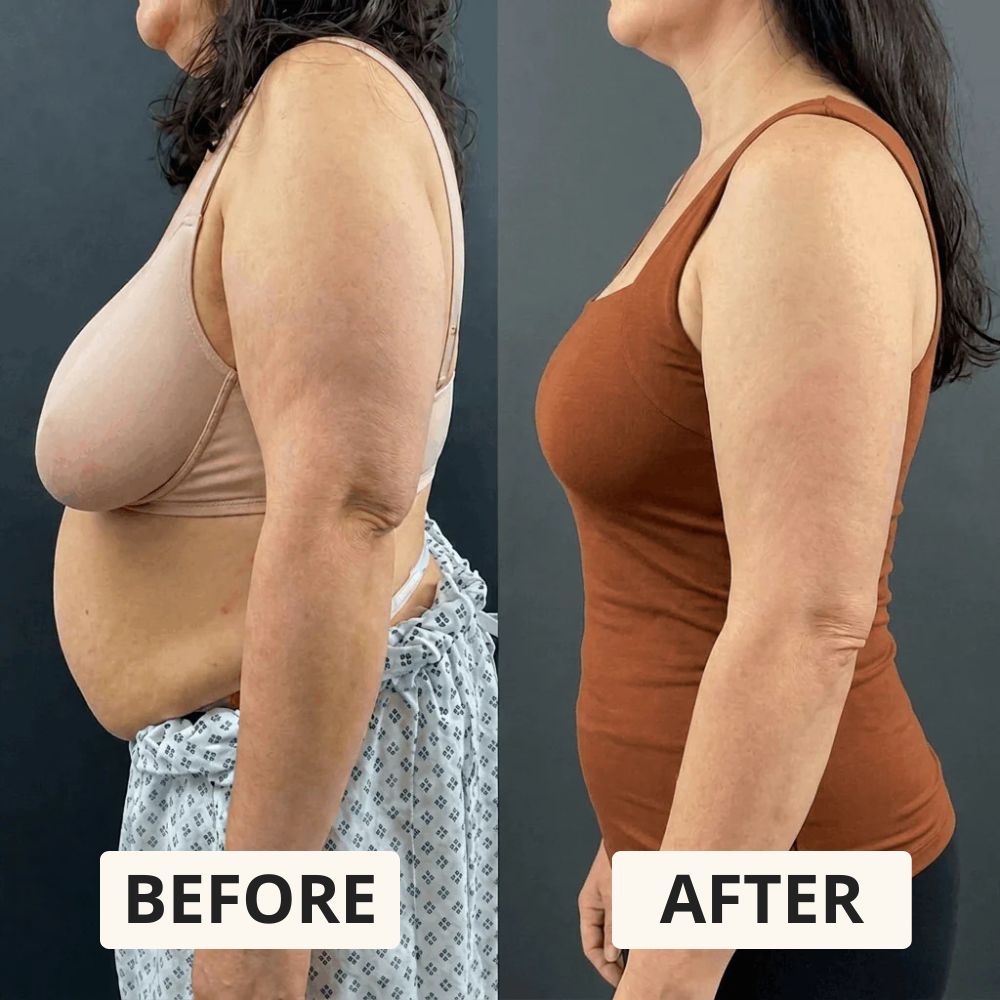 Lindalia built-in bra shaper tank, before and after side