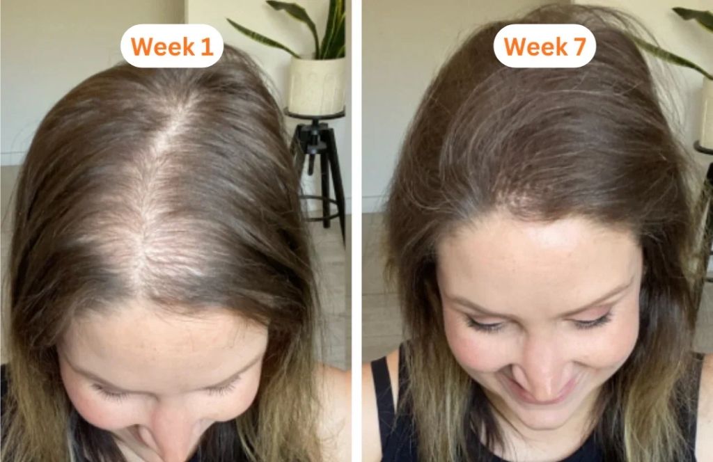 Lindalia Korean Scalp & Hair Growth Serum, before and after