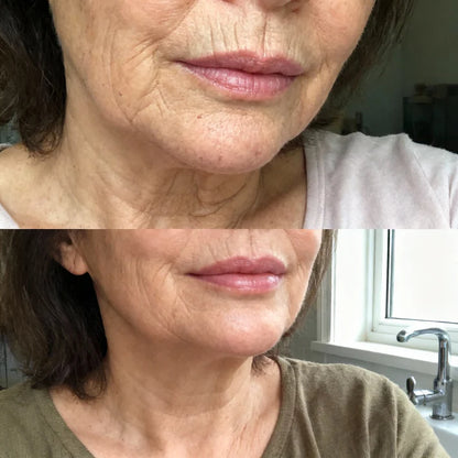 Baume Visage Renouvellement au Calcium Anti-Age