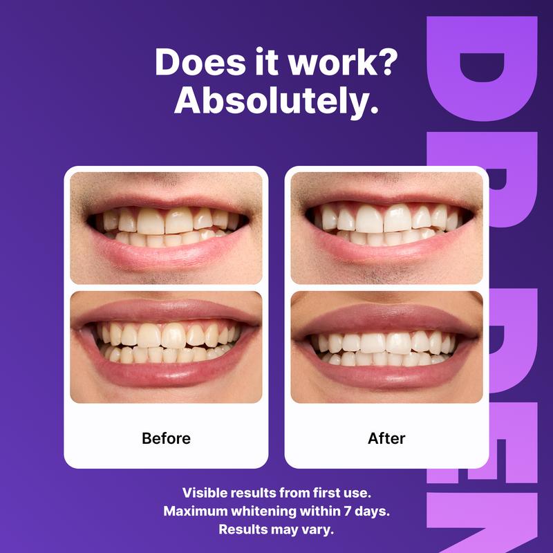Bandelettes Blanchissantes Violettes pour les Dents