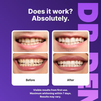 Bandelettes Blanchissantes Violettes pour les Dents