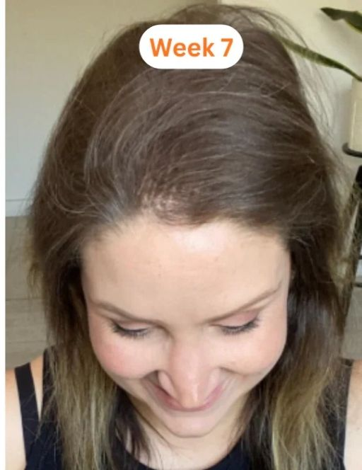 hair_after.png