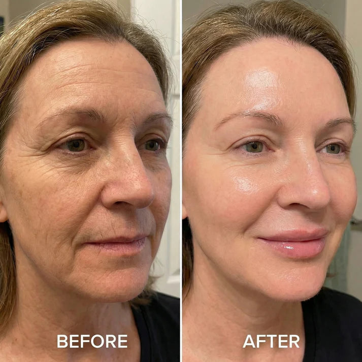 Serum Repulpant Coreen au Collagene Profond Volufiline