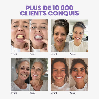 Bain de bouche blanchissant violet