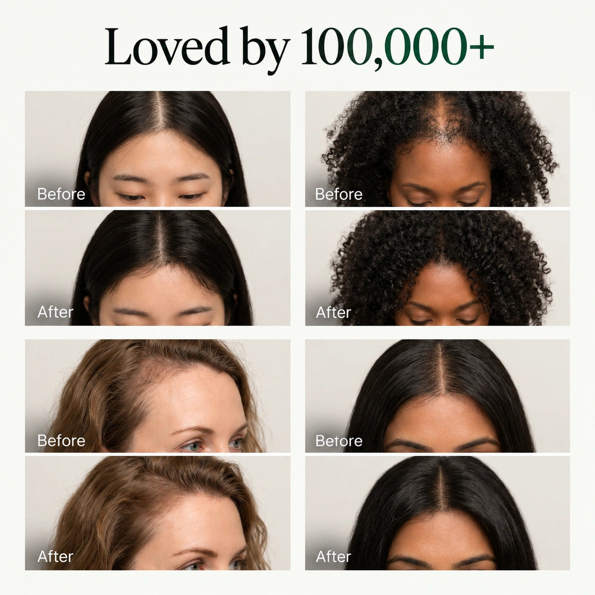 Lindalia Korean Scalp Revival Bar, loved by 100,000+ before and after