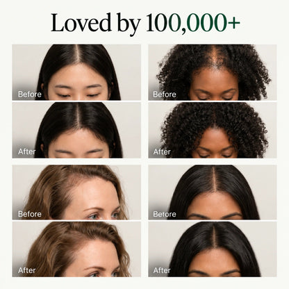 Lindalia Korean Scalp Revival Bar, loved by 100,000+ before and after